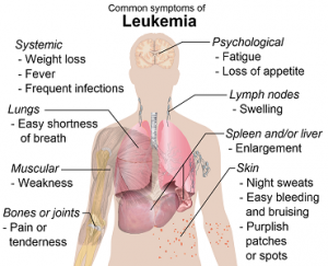 Symptoms of Leukemia