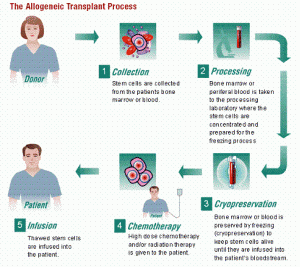stem cell transplantation