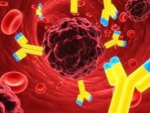 Lymphoma cancer cells